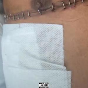 Spinn flow (Explicit)