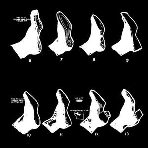 Bully's Lament (Live at KUTX)