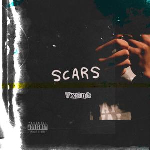 Scars