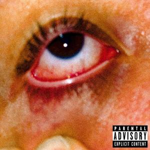 Cataracts (Explicit)