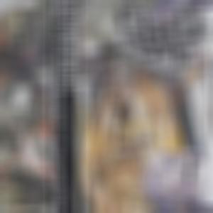 Road to Decomposition Due to Fungating Ulcer