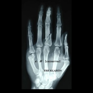 心折 (ここっせつ) (2025 Remastered)