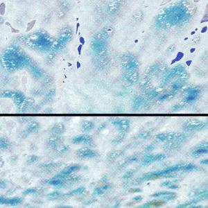 OnTheLine (Explicit)