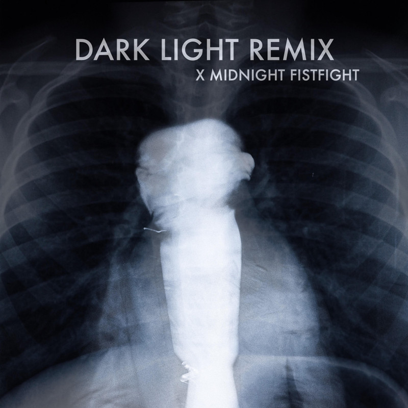 LightItUp封面
