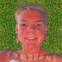 SUNBURNT