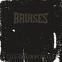 Bruises