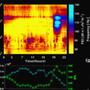 MRI Brain Wave