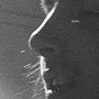 Eyes (Explicit)