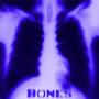 Bones