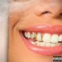 Abriu o Sorriso (Explicit)