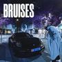 Bruises