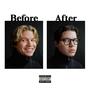 Before & After (feat. Boy & Elon) [Explicit]