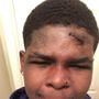 COVERING MY SCARS (Explicit)