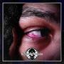 Red Eye (Explicit)