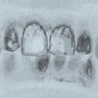 Teeth