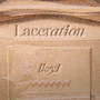 Laceration