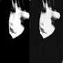 Ijustwanttobemyselfwithyouwhereverigo (Explicit)