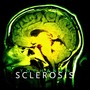 Sclerosis