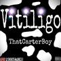 Vitiligo (Explicit)