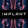 Implant