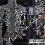 autopsy