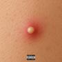 Acnee (Explicit)