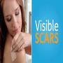 Visible Scars (Explicit)