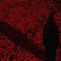 riddance (Explicit)