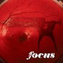 Focus (Deluxe)