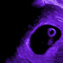 Placenta