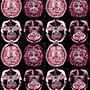 Brain Blast (feat. Royal!) [Explicit]