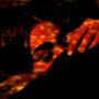 FILO (feat. jcv) [Explicit]