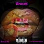 Braces (Explicit)