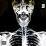 This Is My X-Ray (Explicit)