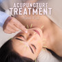 Acupuncture Treatment