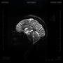 AMNESIA (feat. YnotWest & KeiDaChxnk) [Explicit]