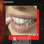 Diamonds In My Teeth (Explicit)