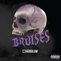 Bruises (Explicit)