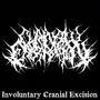 Involuntary Cranial Excision (Split) [Explicit]