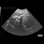 Unborn Child (Explicit)