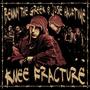 Knee Fracture (Explicit)