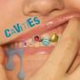 cavities (Explicit)