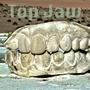 Top Jaw