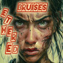 Bruises (Explicit)