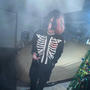 Kill button (Explicit)