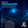 Tachycardia