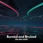Burned and Bruised