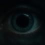 Mydriasis