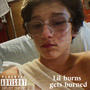 Lil burns gets burned (Explicit)