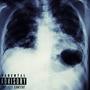Garou II (feat. X) [Explicit]